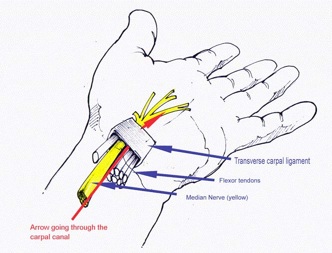 Carpal Tunnel